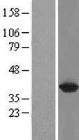 Mutarotase (GALM) Human Over-expression Lysate