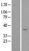 SPATA17 Human Over-expression Lysate