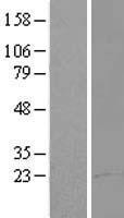 CCDC98 (FAM175A) Human Over-expression Lysate