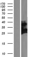 CXorf38 Human Over-expression Lysate