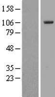 TTC16 Human Over-expression Lysate