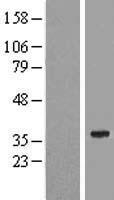 SPATS1 Human Over-expression Lysate