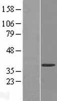 UPRT Human Over-expression Lysate