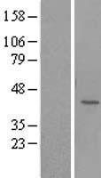 UBLCP1 Human Over-expression Lysate