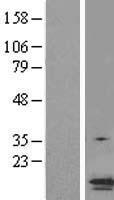 TMS1 (PYCARD) Human Over-expression Lysate