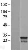 CDCA4 Human Over-expression Lysate