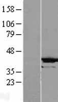 CRYZL1 Human Over-expression Lysate