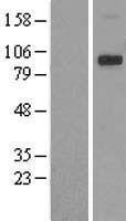 TRPV4 Human Over-expression Lysate