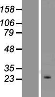 KCNIP4 Human Over-expression Lysate
