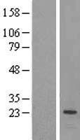 PEAMT (PEMT) Human Over-expression Lysate