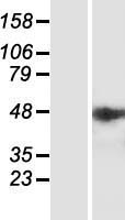 IPMK Human Over-expression Lysate