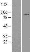 TAS1R3 Human Over-expression Lysate