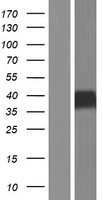 RAGE (AGER) Human Over-expression Lysate