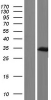 OTX2 Human Over-expression Lysate