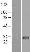 KChIP2 (KCNIP2) Human Over-expression Lysate
