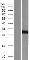 KChIP2 (KCNIP2) Human Over-expression Lysate