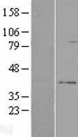 RPUSD3 Human Over-expression Lysate