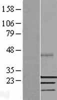 SSX2 Human Over-expression Lysate