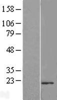 TMUB2 Human Over-expression Lysate