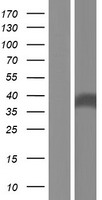 FTSJ1 Human Over-expression Lysate