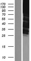 alpha Adducin (ADD1) Human Over-expression Lysate