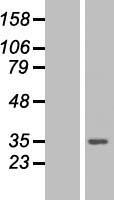 PSME3 Human Over-expression Lysate