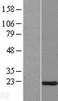 EOLA1 Human Over-expression Lysate