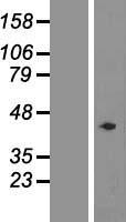 CCRK (CDK20) Human Over-expression Lysate