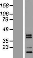 CTRP3 (C1QTNF3) Human Over-expression Lysate