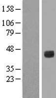 IL6R Human Over-expression Lysate