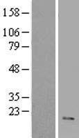 VIP Human Over-expression Lysate