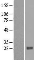 VAX1 Human Over-expression Lysate