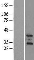 OSCAR Human Over-expression Lysate