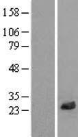 LRRC20 Human Over-expression Lysate