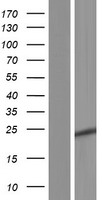 HOATZ Human Over-expression Lysate