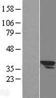 SLC25A3 Human Over-expression Lysate