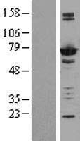 Adenylate kinase 5 (AK5) Human Over-expression Lysate