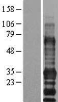 EDARADD Human Over-expression Lysate