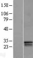 DLX4 Human Over-expression Lysate