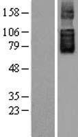 SLC26A6 Human Over-expression Lysate