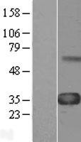 CCN4 Human Over-expression Lysate