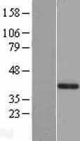 GAB2 Human Over-expression Lysate