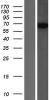 SNX18 Human Over-expression Lysate