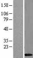 Caspase 8 (CASP8) Human Over-expression Lysate