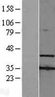 AMID (AIFM2) Human Over-expression Lysate