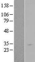 RAB34 Human Over-expression Lysate