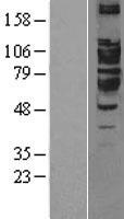 ARTS1 (ERAP1) Human Over-expression Lysate