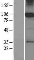 SFMBT1 Human Over-expression Lysate
