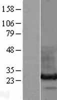 HDGFL3 Human Over-expression Lysate