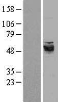 SEPTIN6 Human Over-expression Lysate